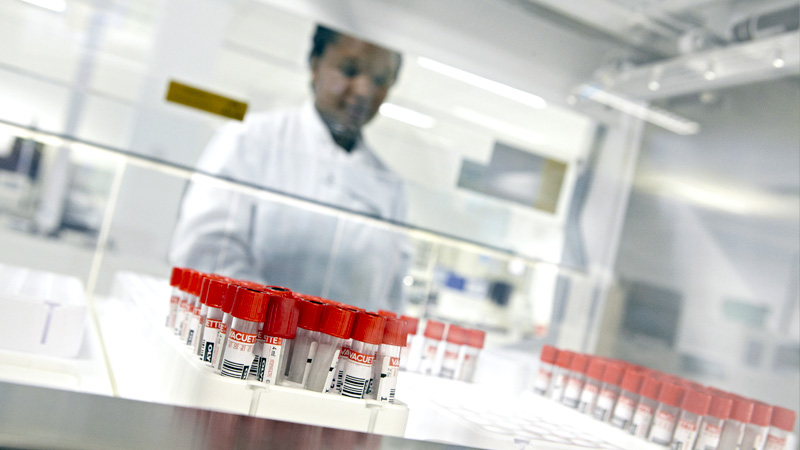 Research carried out at UHB